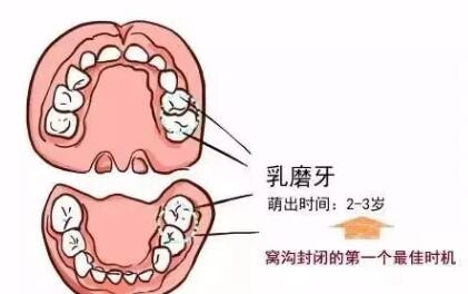 生理鹽水或嬰兒口腔清潔劑,幫助寶寶按摩牙齦,清潔殘留在口腔裡的奶漬